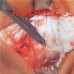 Emetic Cult CD