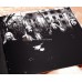 Lightbringer CD